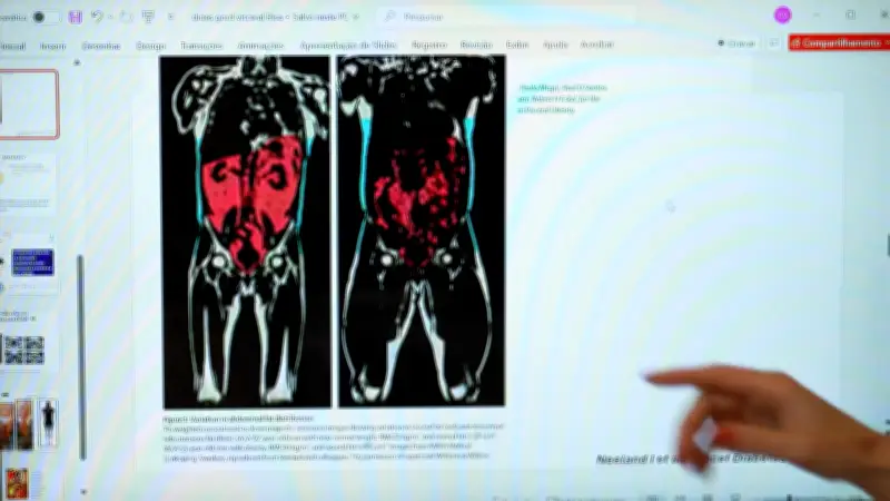 Gordura visceral é a mais perigosa para a saúde, alerta estudo