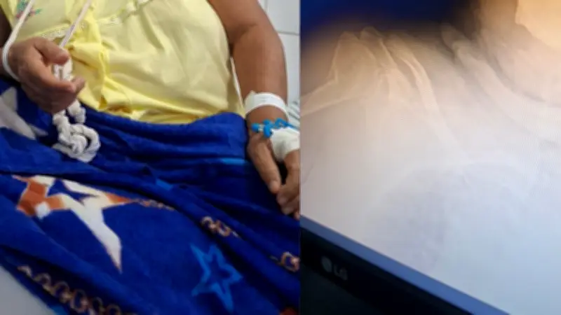 Idosa aguarda há oito dias cirurgia ortopédica em UPA de Teresina