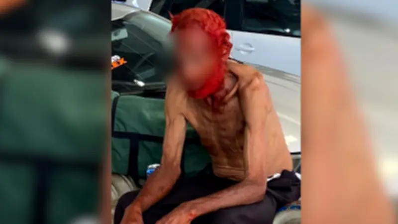 Idoso tem cabelo e barba tingidos por empresário; polícia investiga participantes