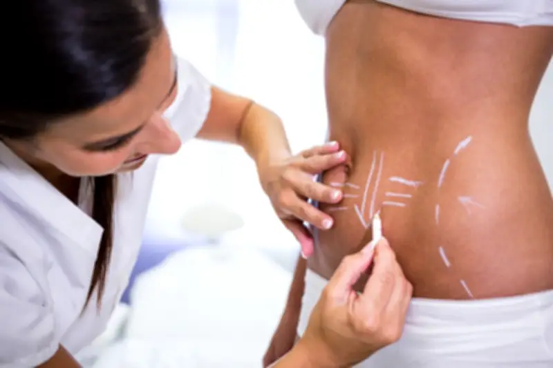 Lipo HD: Nova técnica amplia possibilidades da definição corporal