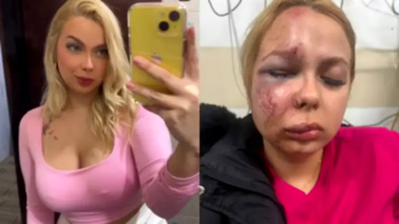 Mulher é espancada em Metrô de SP e sofre múltiplas fraturas