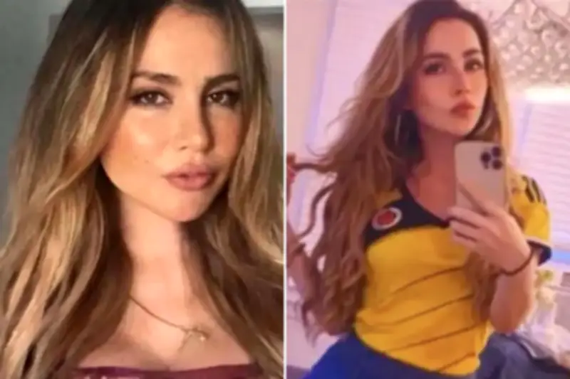 Mulher morre em cirurgia para retirar preenchimento tóxico nos glúteos na Colômbia
