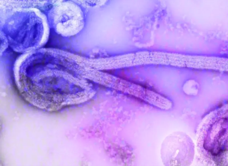 Novo caso suspeito de ebola em SP: brasileira de 31 anos vinda do Congo