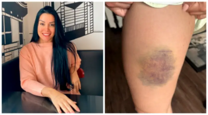 Nutricionista que lutou contra homem mudou para SP para expandir carreira