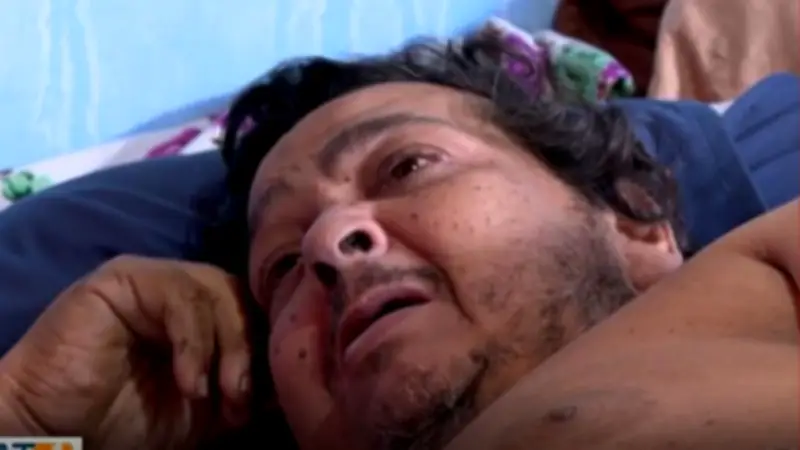 Paciente obeso e acamado aguarda atendimento médico em Cuiabá