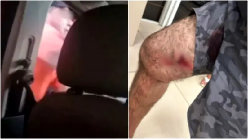 Policial militar é solto após balear homem em Aquiraz; defesa alega legítima defesa