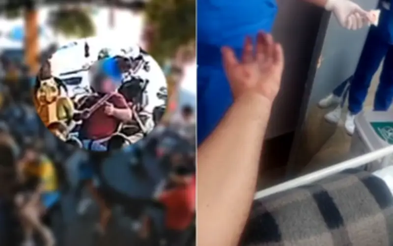 Torcedor tem mão dilacerada por fogos em Jaraguá após jogo do Brasil