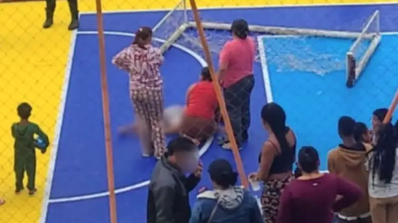 Trave cai em cabeça de criança em Itajaí; menino de 10 anos está na UTI