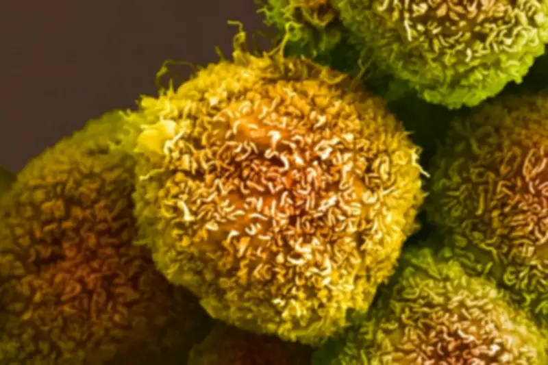 Vacina de mRNA contra câncer de pâncreas mostra resultados promissores