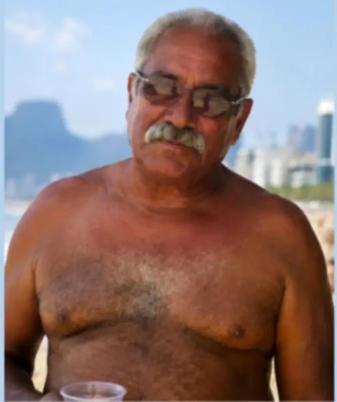 Vaquinha para dono da Barraca do Uruguai após amputação