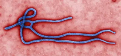 Americano com ebola recebe alta após 17 dias internado em Berlim
