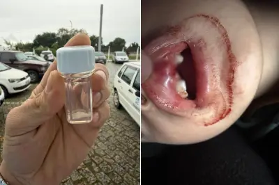 Criança de 2 anos quebra dente após queda em creche em Registro