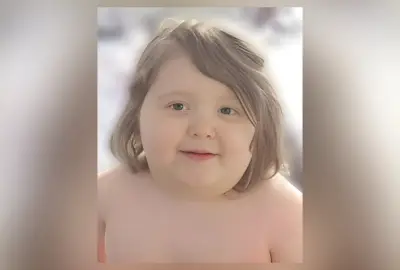 Menino de 7 anos com obesidade mórbida morre; pais presos por homicídio