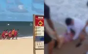 Estado de saúde de vítimas de ataques de tubarão em PE é grave