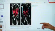 Estudo: gordura visceral é a mais perigosa; veja como identificar