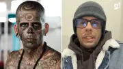 Ex-homem mais tatuado do Brasil remove tatuagens do rosto após conversão