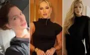 Fios Aptos: técnica de lifting não cirúrgico conquista famosas como Virginia Fonseca