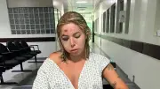 Jovem fratura rosto após ser atropelada por motorista de app em Florianópolis