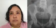 Mulher de 37 anos fingia ter 12 anos e foi acolhida em Joinville