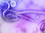 SP descarta 2º caso suspeito de ebola em 2025