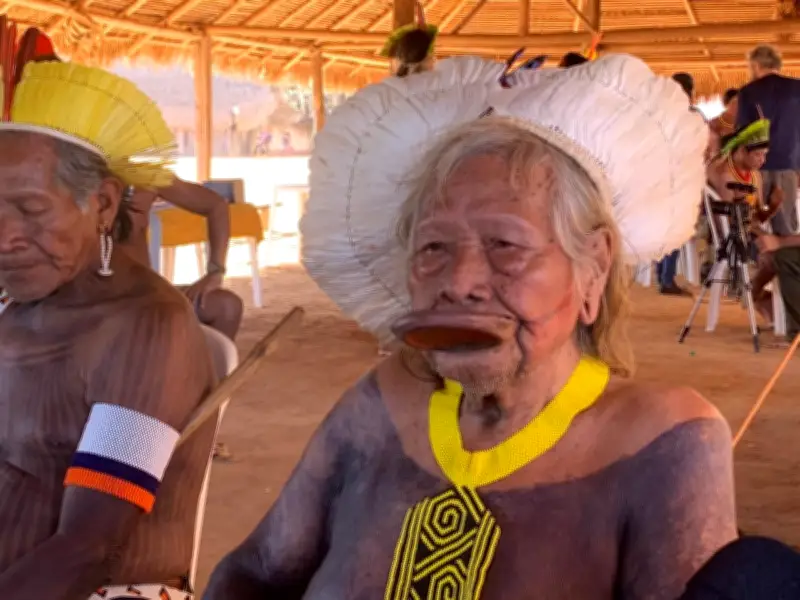 Cacique Raoni tem dreno de tórax retirado e segue estável na UTI