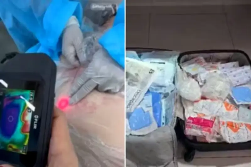 Esteticista presa por procedimentos irregulares em Santos é solta após fiança de R$ 8 mil