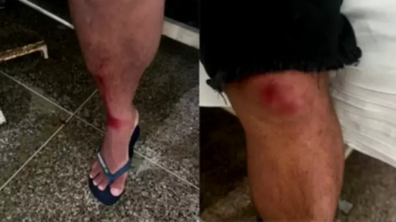 Homem é preso por agredir tio com pá após briga por benefício da avó no PI