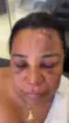 Cabeleireira denuncia agressão de PMs no São João de Maceió