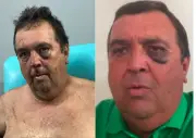Vereador é sequestrado, agredido e amarrado em Brejinho, RN